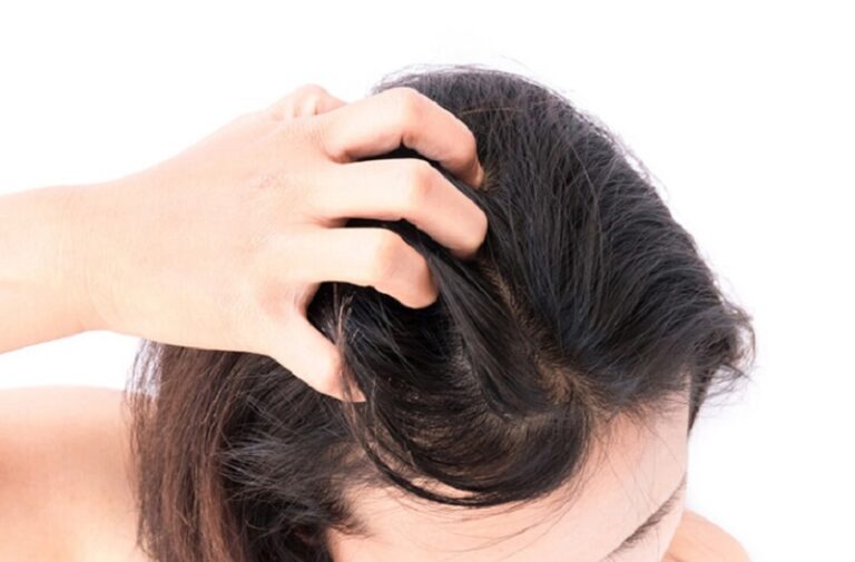 Dầu gội trị nấm da đầu giúp đánh bay nấm hiệu quả