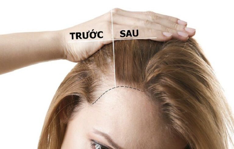 Cách sử dụng vitamin B5 mọc tóc hiệu quả