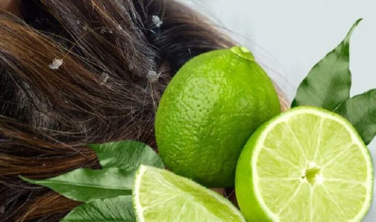 Bật mí cách trị nấm da đầu bằng chanh hiệu quả
