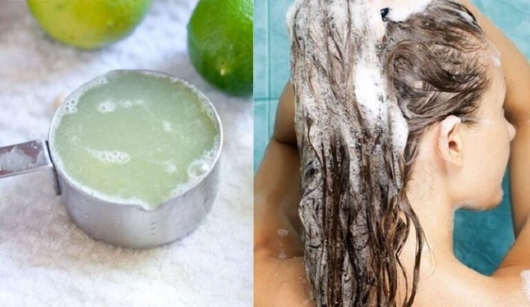 Trị nấm da đầu bằng chanh hiệu quả