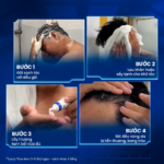 Kem Bôi Stada 200 Cream Biocarepharma