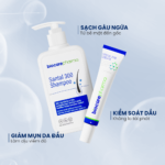 Combo Santal 300 Shampoo, Stada 200 Cream Hỗ Trợ Gàu – Ngứa