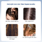 Combo dầu gội Santal 300 và dầu xả Soft 250 dành cho tóc gàu ngứa