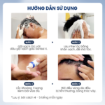 Combo Gàu Ngứa Thế Hệ Mới Santal X & Kem Bôi Stada 200