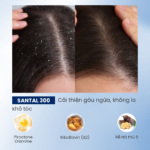 Dầu gội gàu ngứa Santal 300 BiocarePharma