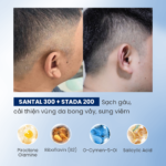 Combo Santal 300 Shampoo, Stada 200 Cream Hỗ Trợ Gàu – Ngứa