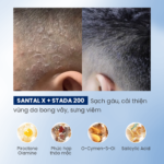 Combo Gàu Ngứa Thế Hệ Mới Santal X & Kem Bôi Stada 200