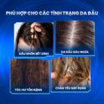 Dầu xả chuyên cho da đầu gàu ngứa Soft 250 Conditioner