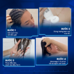 Dầu xả chuyên cho da đầu gàu ngứa Soft 250 Conditioner