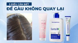 5 điều giúp sạch gàu.
