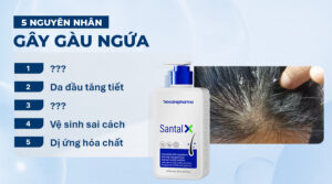 5 “Thủ Phạm” Chính Gây Ra Gàu & Tại Sao Da Đầu Lại Bị Ngứa Dai Dẳng?