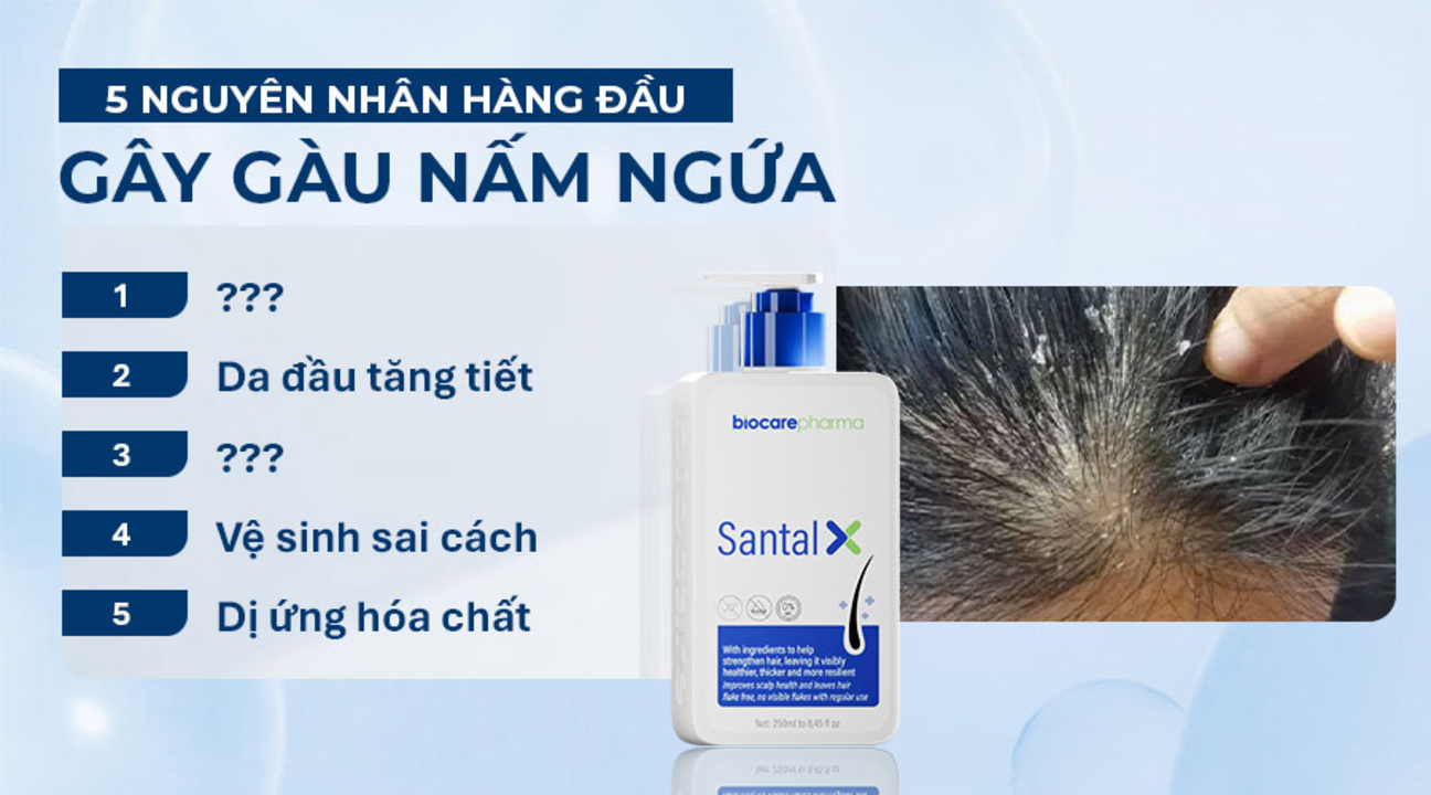 5-nguyen-nhan-hang-dau