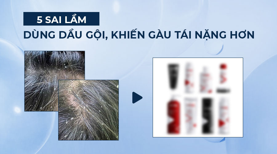 5-sai-lam-dung-dau-goi-khien-gau-tai-nang-hon