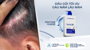 [Review Chi Tiết] Dầu Gội Gàu Thảo Mộc Santal X Có Tốt Không?